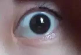 美瞳線掉痂，我扣了一下，結(jié)果不上色了！