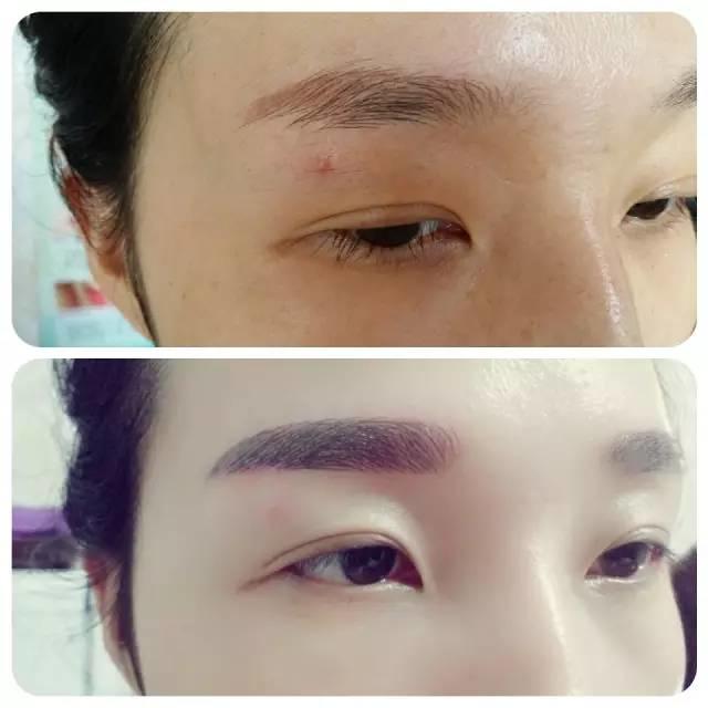 美瞳線掉痂，我扣了一下，結(jié)果不上色了！