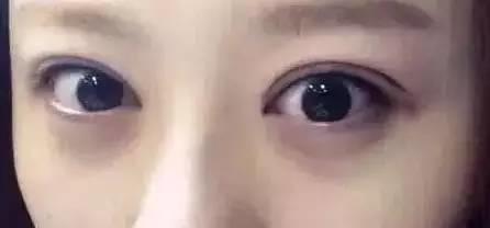 美瞳線掉痂，我扣了一下，結(jié)果不上色了！